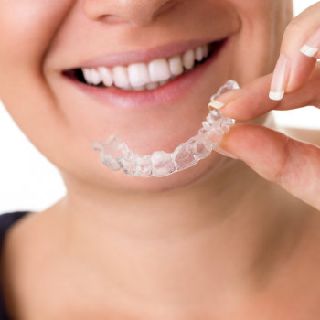 Woman inserting a clear orthodontic aligner into her mouth.
